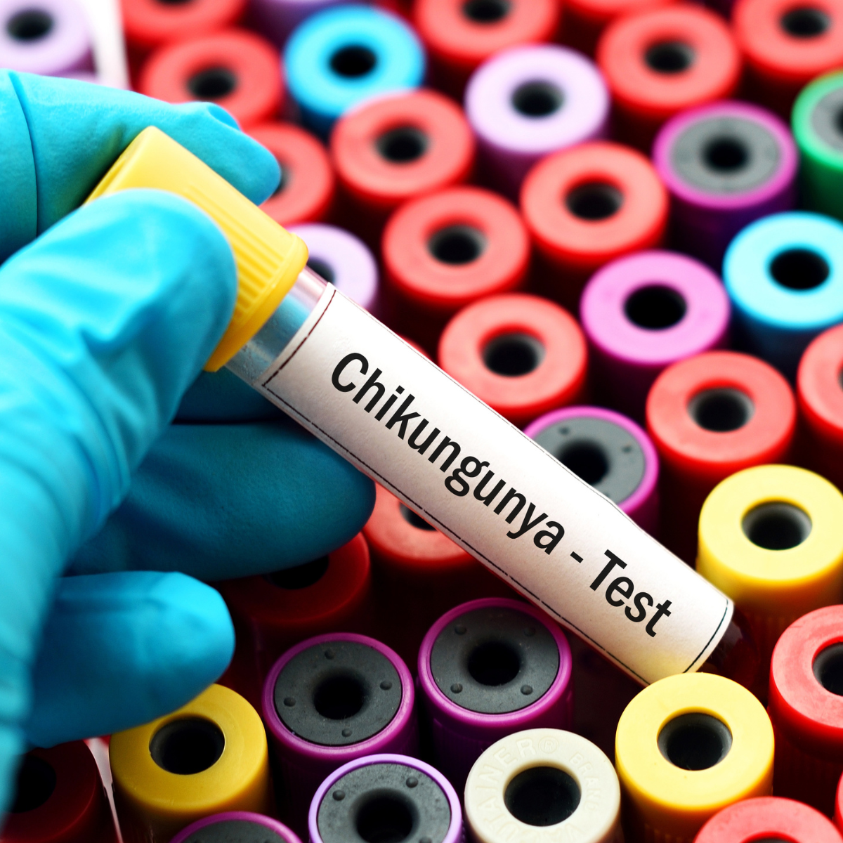 Chikungunya